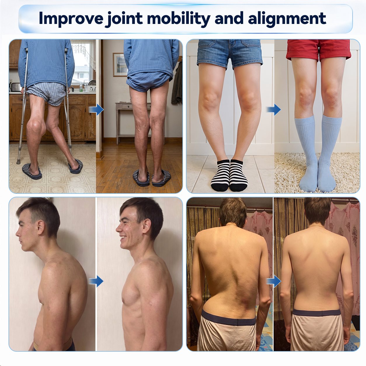 𝗜𝐅𝙈𝗔𝑮𝗜𝐂® 💠 𝟬.𝟬𝟱𝗺𝗺 𝐌𝐢𝐜𝐫𝗼𝗻𝗲𝗲𝙙𝙡𝙚 𝑩𝒐𝒏𝒆 & 𝐉𝐨𝗶𝗻𝘁 𝗥𝗼𝗹𝗹𝒆𝙧🧿