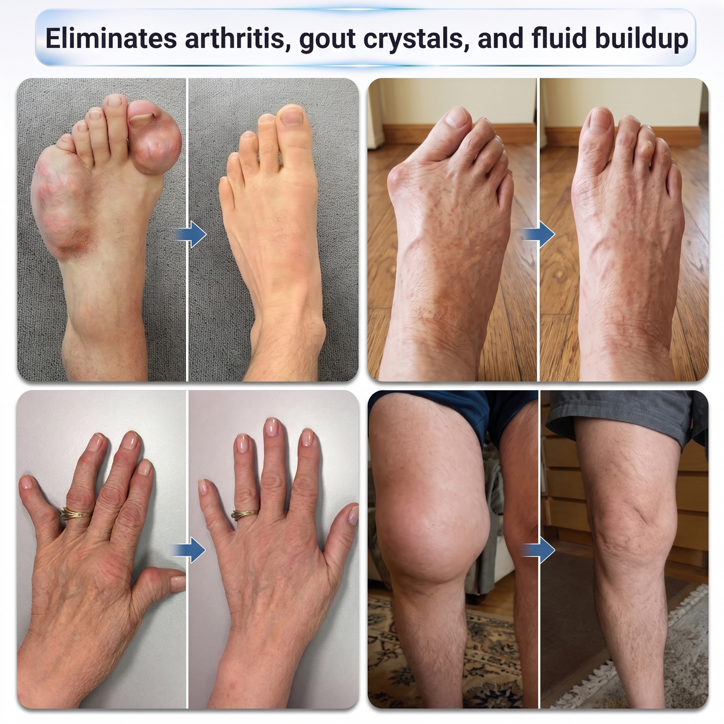 𝗜𝐅𝙈𝗔𝑮𝗜𝐂® 💠 𝟬.𝟬𝟱𝗺𝗺 𝐌𝐢𝐜𝐫𝗼𝗻𝗲𝗲𝙙𝙡𝙚 𝑩𝒐𝒏𝒆 & 𝐉𝐨𝗶𝗻𝘁 𝗥𝗼𝗹𝗹𝒆𝙧🧿