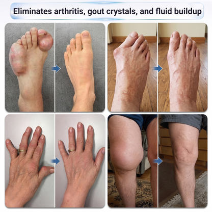 𝗜𝐅𝙈𝗔𝑮𝗜𝐂® 💠 𝟬.𝟬𝟱𝗺𝗺 𝐌𝐢𝐜𝐫𝗼𝗻𝗲𝗲𝙙𝙡𝙚 𝑩𝒐𝒏𝒆 & 𝐉𝐨𝗶𝗻𝘁 𝗥𝗼𝗹𝗹𝒆𝙧🧿